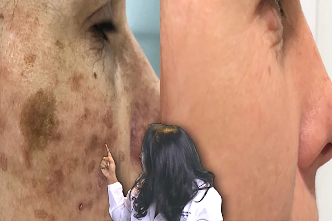 Sick of Dark Spots? Ageless 72 Year Old Says This Household Item Is All She Uses